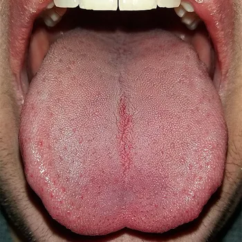 لسانات عجل مسلوقة بمرق الثوم والحامض والنعناع